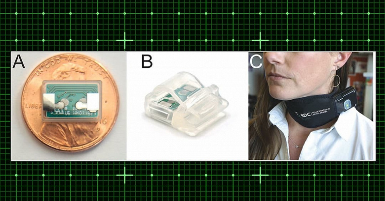 Учёные: воротник с током победил ПТСР. Результаты испытаний названы «очень многообещающими»